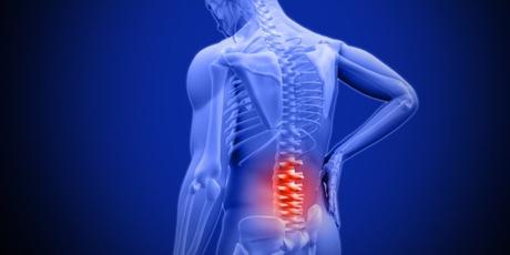 What is Superion for patients who have spinal stenosis?