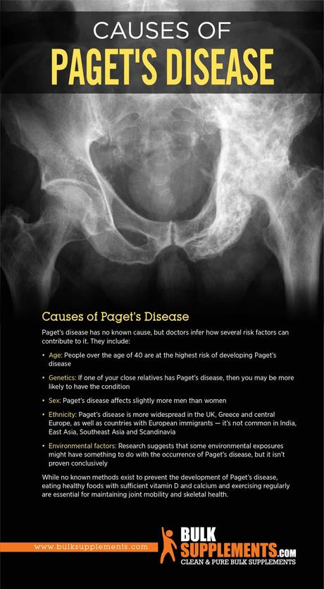 Causes of Paget's Disease