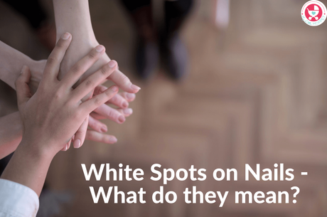 Have you noticed White Spots on Nails on your child's hands or feet? Find out what they could be and what you can do about them.