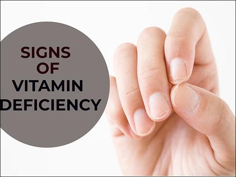 Natural Cure For Deficiency of Vitamin D