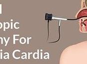 Natural Cure Achalasia Cardia