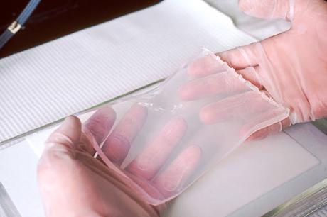 Southern blotting market further in the next years. Furthermore, the rising need for speedier detection of chronic diseases such as cancer, congenital adrenal hyperplasia, and HIV-1 expected to propel the Southern blotting market further in the next years.