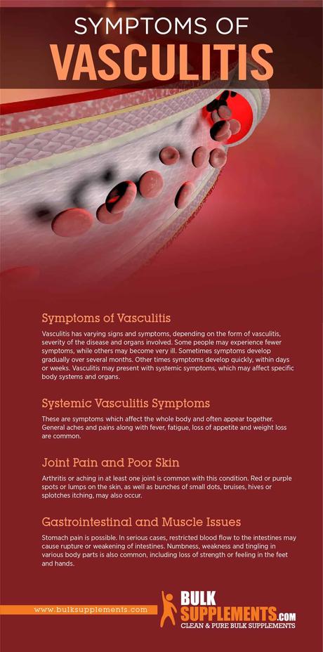 Symptoms of Vasculitis