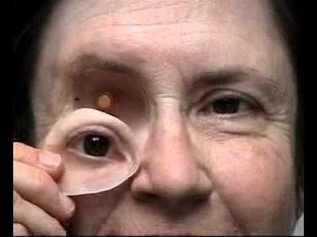 The Ocular Implant Market is expected to develop in the next years as a result of the aforementioned cases, One of the major factors driving the global Ocular Implant Market is technological improvements in ocular implants.