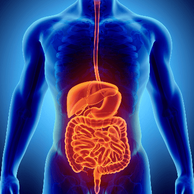 What is Inflammatory Bowel Disease?