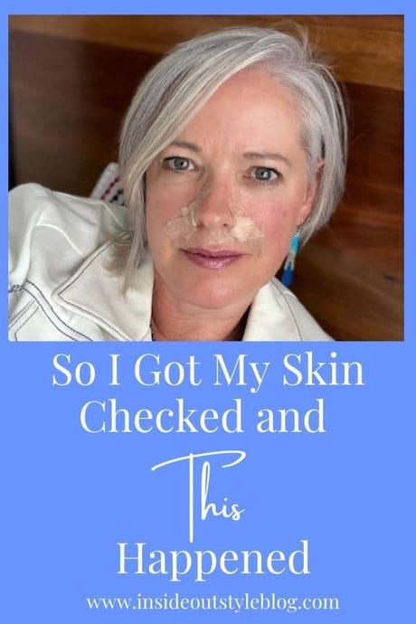 So I Got My Skin Checked and This Happened So I Got My Skin Checked and This Happened