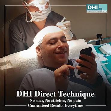 Still Searching for The Best Hair Transplant Surgeon in Guwahati?