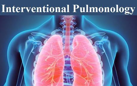 worldwide interventional pulmonology market has grown