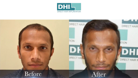 Are your constant hair problems taking a toll on you? Are your constant hair problems taking a toll on you?