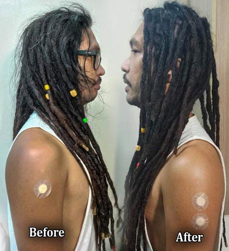 Dirt and Shampoo Residue Accumulation on a Two-Year-Old Dreadlocks Hairstyle.