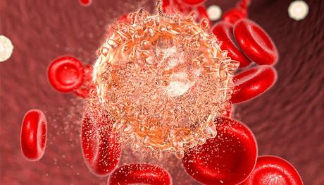 Hematopoietic Stem Cell Transplantation (HSCT) Market Multipotent hematopoietic stem cells derived from peripheral blood cells, bone marrow, or umbilical cord blood are implanted into the patient during hematopoietic stem cell transplantation.