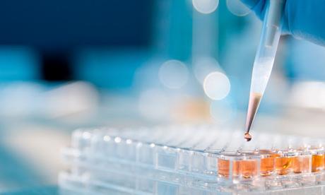 Enzyme Linked Immunosorbent Assay (ELISA) Market Enzyme Linked Immunosorbent Assay, and it is a type of immunoassay that is used to identify proteins, peptides, antibodies, and hormones.