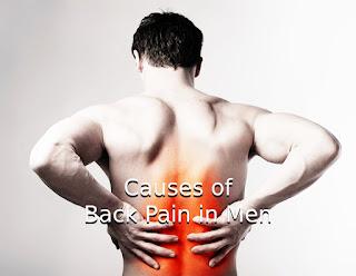 Causes of Back Pain in Men