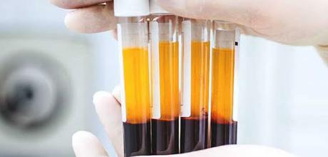 Definition of the Global Platelet Rich Plasma Market