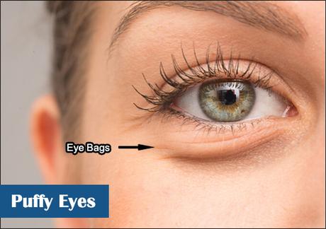 How To Get Rid Of Puffy Eyes With Ayurveda!