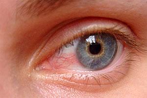 Diabetic Retinopathy Market Diabetic retinopathy is a serious medical disorder that damages the eyes as a result of diabetes.