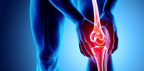 Total Knee Arthroplasty Market The articular surfaces (femoral condyles and tibial plateau) of the knee joint are replaced with smooth metal and highly cross-linked polyethylene plastic in total knee arthroplasty (TKA) or total knee replacement (TKR), which is a frequent orthopedic procedure.