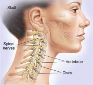 Understanding Cervical Spine Instability Measurements