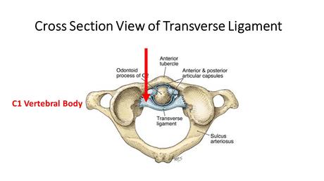 Understanding Cervical Spine Instability Measurements