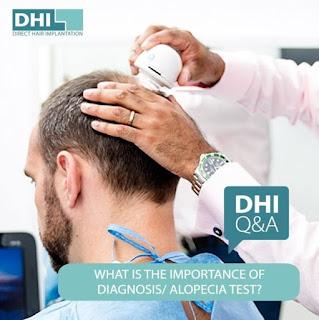 Things you need to know before heading for the best hair transplant in Lucknow