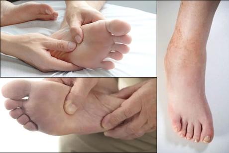 How to Treat Plantar fascia Naturally With Ayurveda