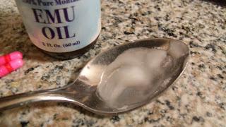 Homemade Benadryl Cream (for external use only)