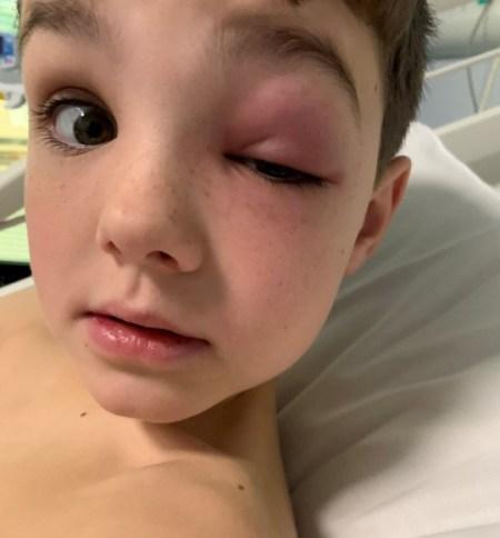 Meet The 9-Year-Old Boy Who Almost Went Completely Blind After Suffering Rare ‘Covid Eye’