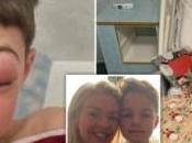 Meet 9-Year-Old Almost Went Completely Blind After Suffering Rare ‘Covid Eye’