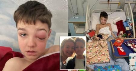Meet The 9-Year-Old Boy Who Almost Went Completely Blind After Suffering Rare ‘Covid Eye’