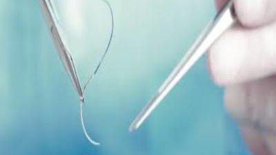 Surgical Sutures Market A surgical suture is one of the most common medical devices used by doctors during surgery. After an accident or surgery, a suture keeps the body's tissues together by maintaining their structural integrity, or holding them together as required.