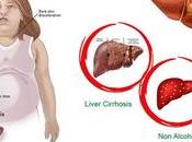What Things Responsible Non-Alcoholic Fatty Liver Ancient Remedies