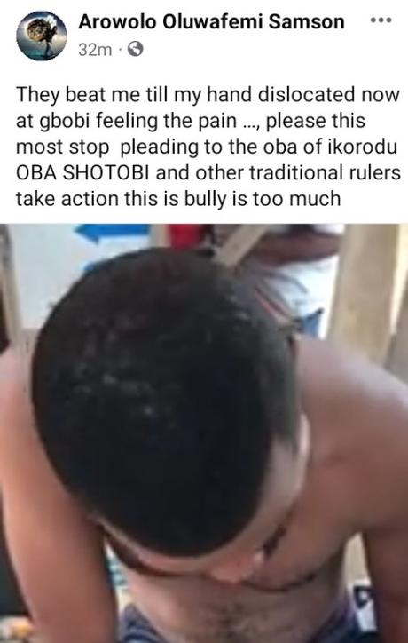 Police Officers Beat The Hell Out Of Young Man, Break His Hand After Accusing Him of Being A Yahoo Boy (Photos)
