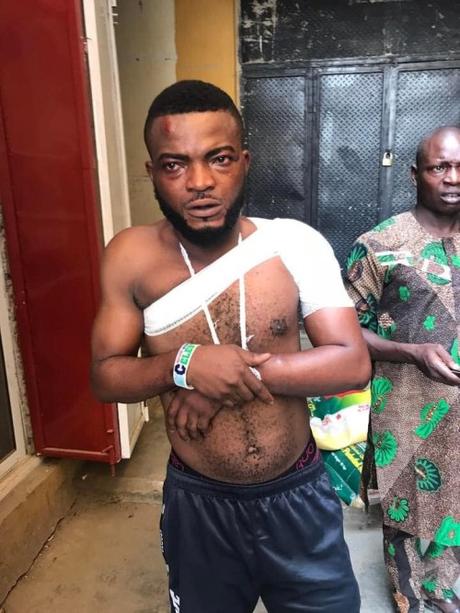 Police Officers Beat The Hell Out Of Young Man, Break His Hand After Accusing Him of Being A Yahoo Boy (Photos)
