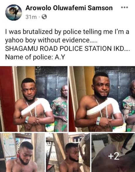 Police Officers Beat The Hell Out Of Young Man, Break His Hand After Accusing Him of Being A Yahoo Boy (Photos)