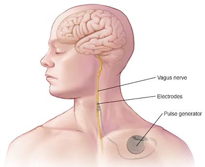 What The Vagus Nerve Is And How To Stimulate It!