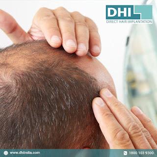 Hair transplant has transformed the lives of many patients. Are you ready to change yours? Hair transplant has transformed the lives of many patients. Are you ready to change yours?