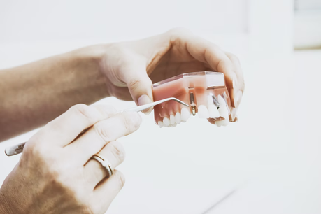 Important Things You Need To Know Before Getting Dental Implants