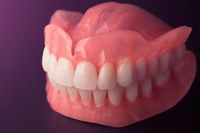 Dentures Market Dentures are prosthetic devices that are designed to replace lost teeth and are supported by the oral cavity's soft and hard tissues.
