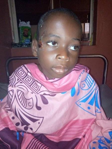 Oh No! Little Boy Severely Abused, Beaten And Left N*ked In Bush In Akwa Ibom (Photos)
