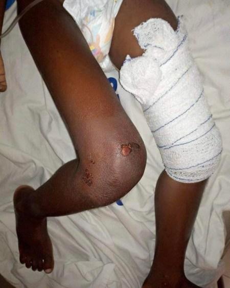 Oh No! Little Boy Severely Abused, Beaten And Left N*ked In Bush In Akwa Ibom (Photos)