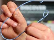 Global Ureteral Stents Market Research Report: Analysis Outlook Forecast Till 2026