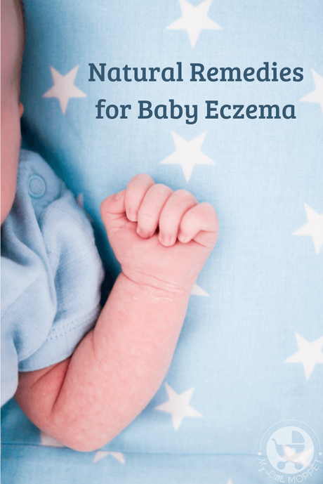 If you're struggling with baby eczema, you're not alone. Here are 12 natural home remedies for Baby Eczema that have worked for other parents like you.