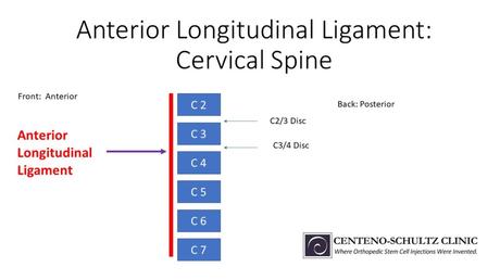 Anterior Longitudinal Ligament: Could This Be Responsible for Your Ongoing Neck Pain?