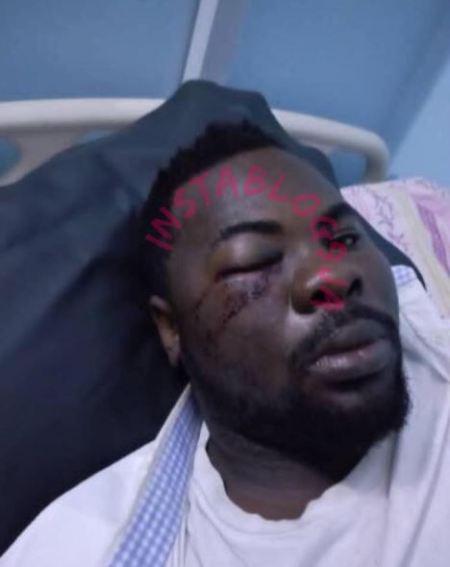 Man Allegedly Brutalizes Bartender Over N53k Bill In Imo (Photo)