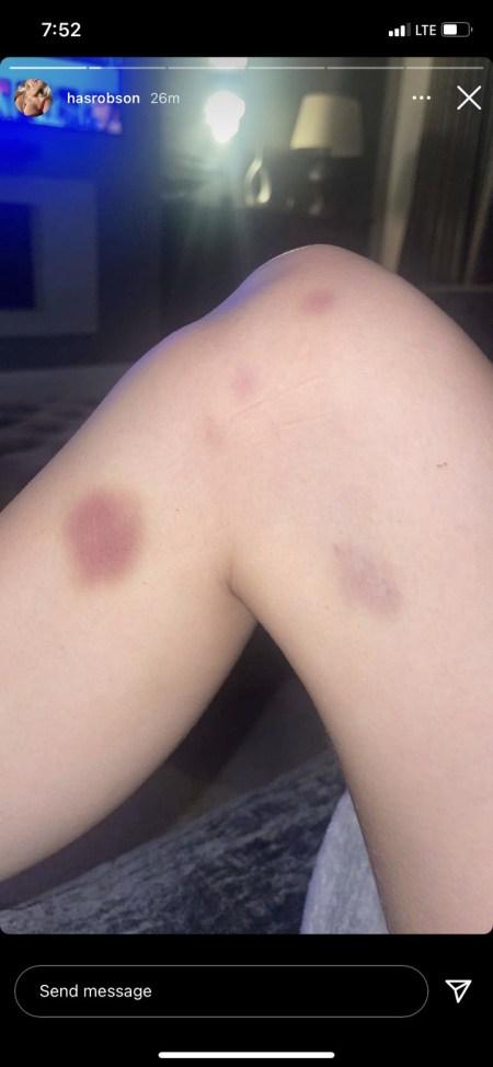 Manchester United Star, Greenwood Accused Of S*xual Assault, Domestic Violence (Photos)