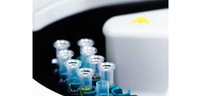 Ion-Selective Clinical Lab Analyzers Market Ion-selective analyzers use ion-selective electrodes to detect specific ions in the presence of other ions and ion concentrations in an analytical solution, which is usually whole blood, plasma, or serum.