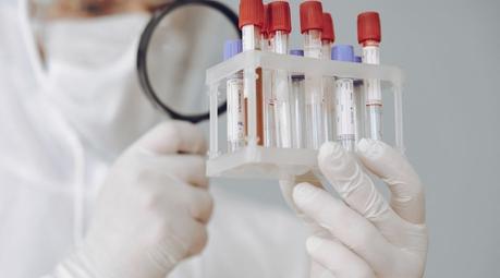 Prolactin: Test, normal ranges, results, high vs low