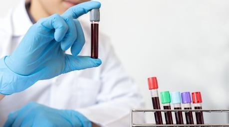 Prolactin: Test, normal ranges, results, high vs low