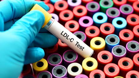 Is elevated LDL cholesterol harmful?