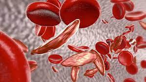 Hemoglobinopathy Market